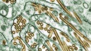 Influenza A H5N1 under the microscope