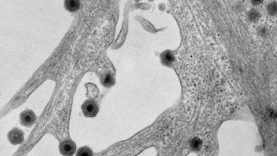 TEM of ASFV infected cells