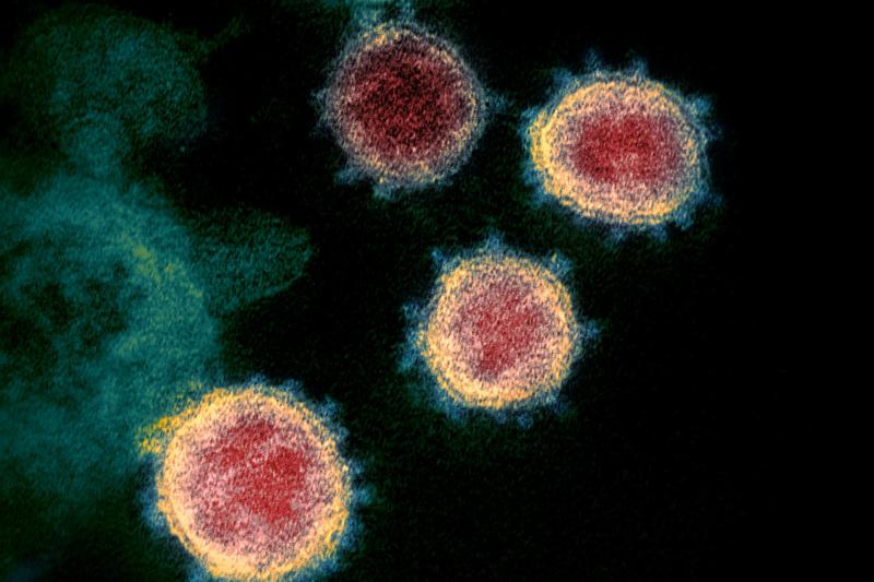 Coloured image of SARS-CoV-2 viruses