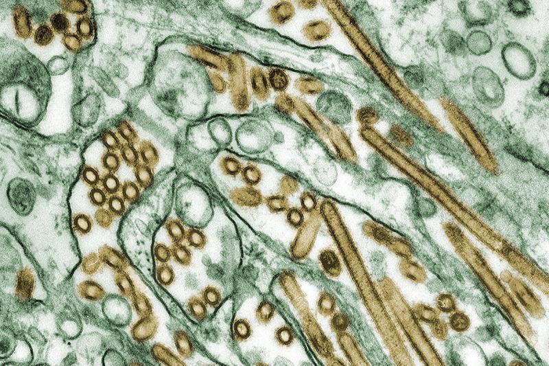 Influenza A H5N1 under the microscope