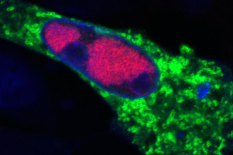 Image of a cell infected with Mareks disease