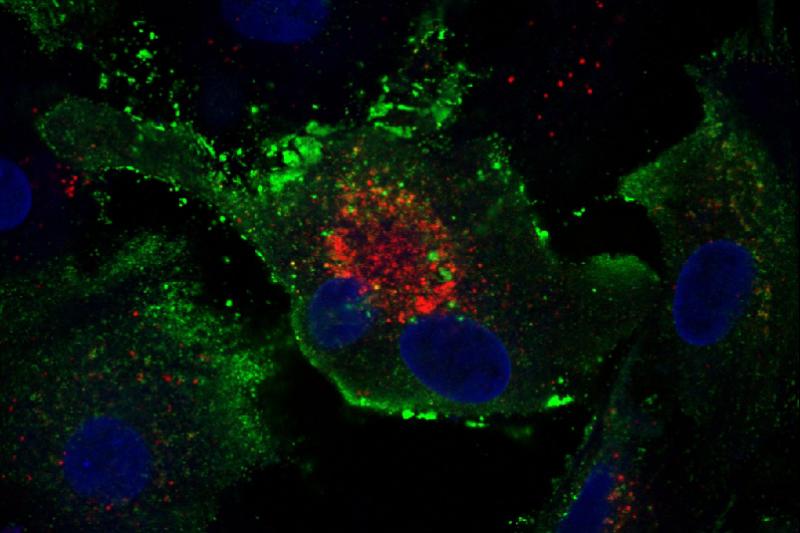 M41 infection in primary chicken kidney cell cultures. They have been labelled anti-E (red) and anti-IBV (green) and the nuclei are labelled blue with DAPI. 