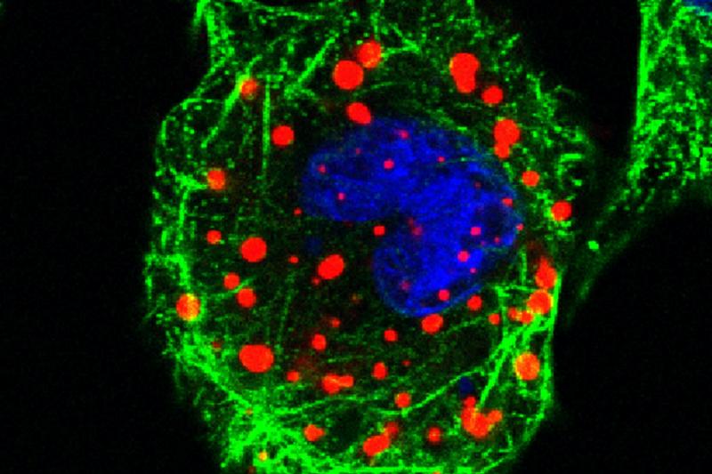 IBDV infected cell (red), tubulin (green) and the nucleus (blue)