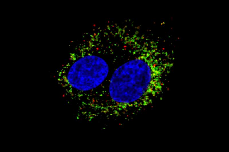 cells infected with infectious bronchitis (blue nucleus, red virus)