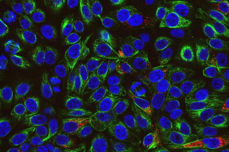 IBV strain M41-CK (red) growing in Vero cells (green with blue nuclei) in the presence of trypsin 