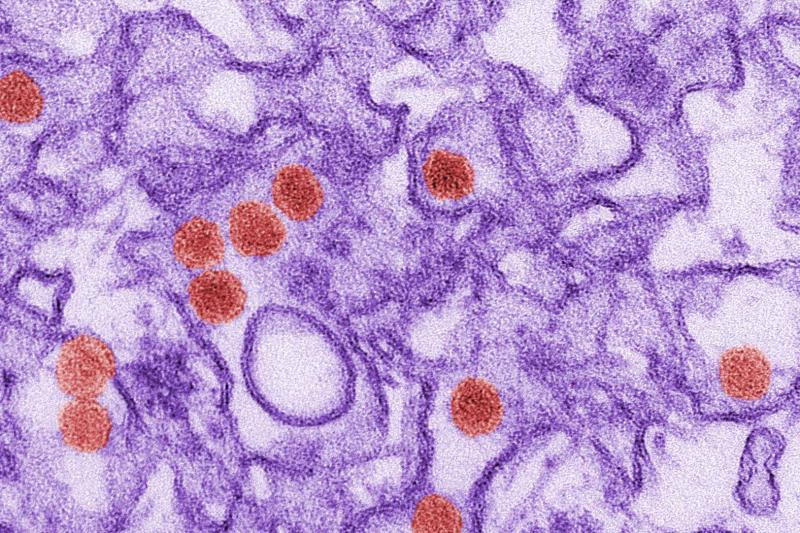 A digitally colorized transmission electron microscopic (TEM) image of Zika virus. Virus particles are coloured red, the rest of the cell image is purple.