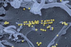 Scanning electron micrograph of Crimean-Congo hemorrhagic fever (CCHF) viral particles (yellow) budding from the surface of cultured epithelial cells from a patient. Credit: NIAID - Creative Commons Attribution 2.0 Generic 