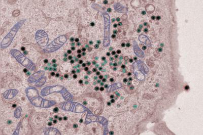 A cell infected by African swine fever virus