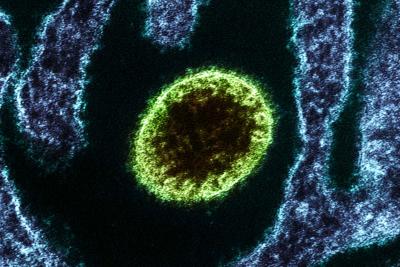 Nipah virus particle