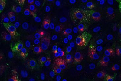 Beaudette infection in primary chicken kidney cell cultures. They have been labelled anti-E (red) and anti-IBV (green) and the nuclei are labelled blue with DAPI. 