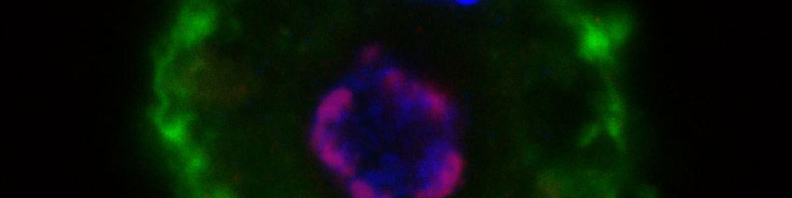 A macrophage infected with ASFV