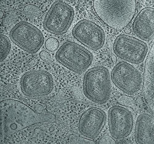 Electron cryotomography image of a cell infected by vaccinia virus