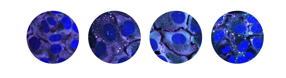 Understanding the mechanisms of mitochondrial rewiring during viral ...