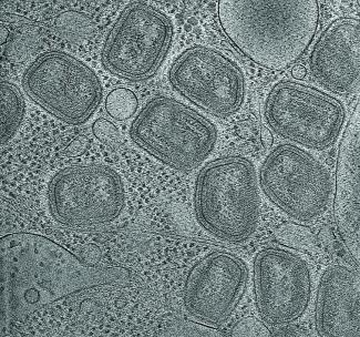 Electron cryotomography image of a cell infected by vaccinia virus