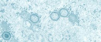 A microscopic image of a virus