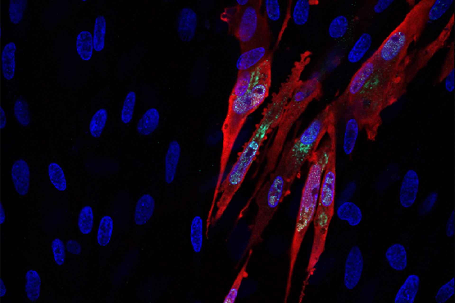 MDV vaccine expressing a infectious bursal disease protein Marek's disease virus vaccine