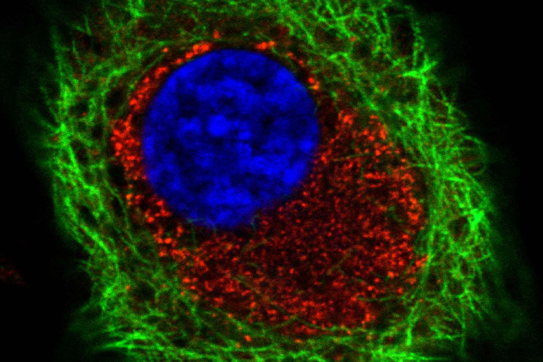 fmd virus infected cell foot-and-mouth disease infected cell