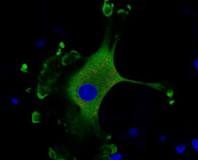 Bluetongue infected dendritic cell Bluetongue infected dendritic cell