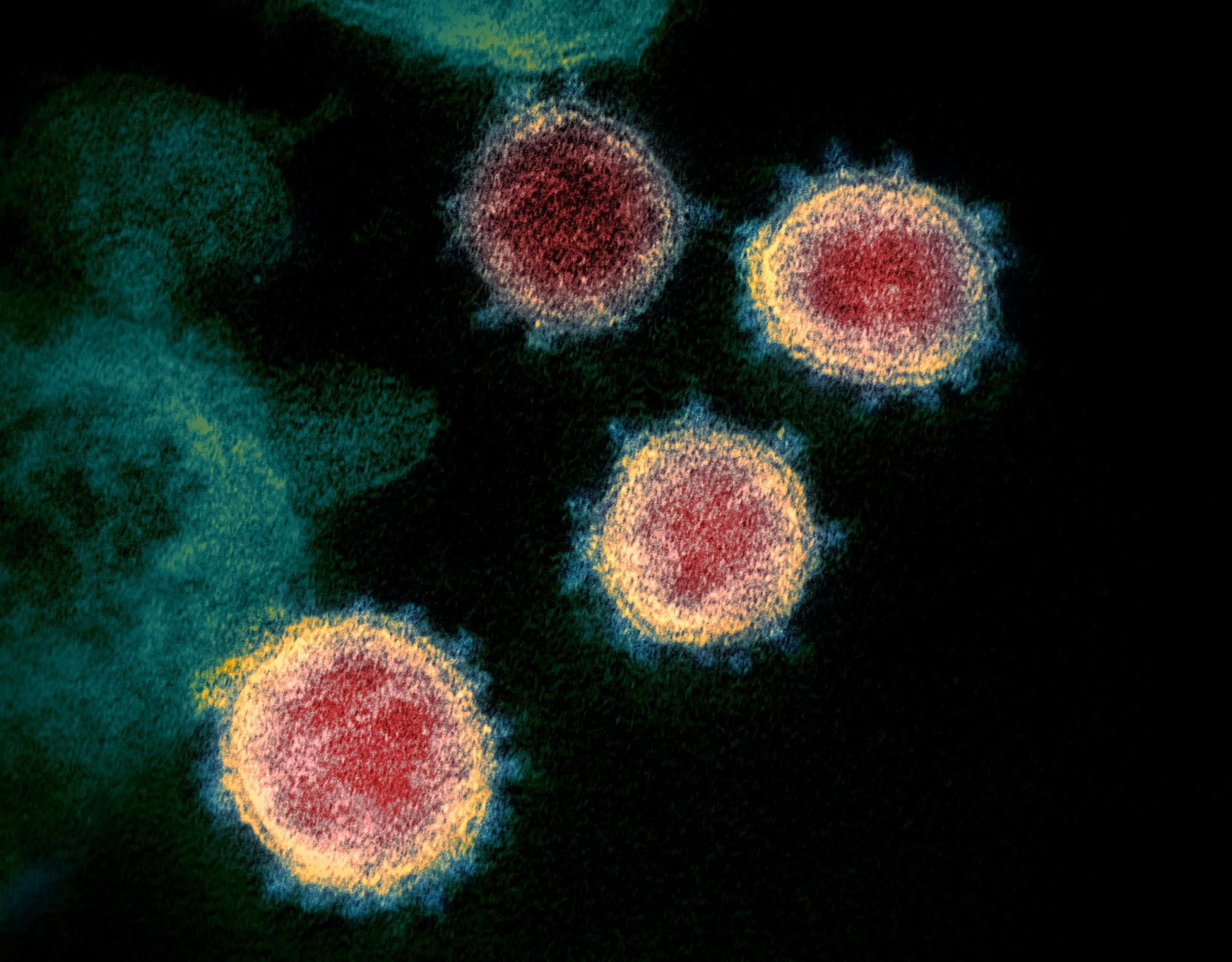 SARS-CoV-2 virus Transmission electron microscope image shows SARS-CoV-2, the virus that causes COVID-19. Crown-like spikes on the outer edge of the virus particles give coronaviruses their name.
